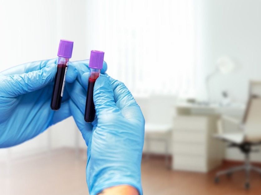 EUC laboratoře - odběrové místo Kolín